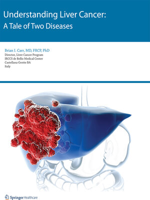 cover image of Understanding Liver Cancer